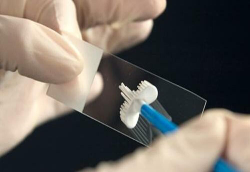 Prahova. Continuă testarea gratuită Babeș-Papanicolau și HPV