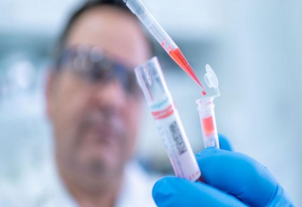 Motivul pentru care în Germania sunt atât de puţine decese de coronavirus. Câte teste se fac pe zi