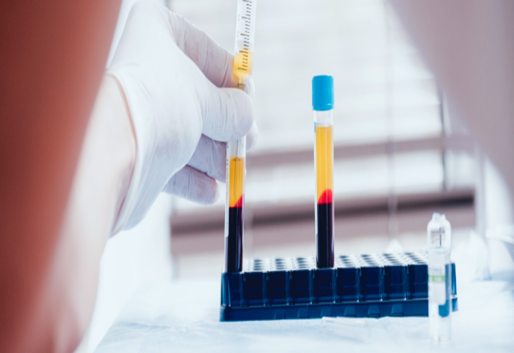 Prahova. Puțini donatori de plasmă cu SARS-COV-2