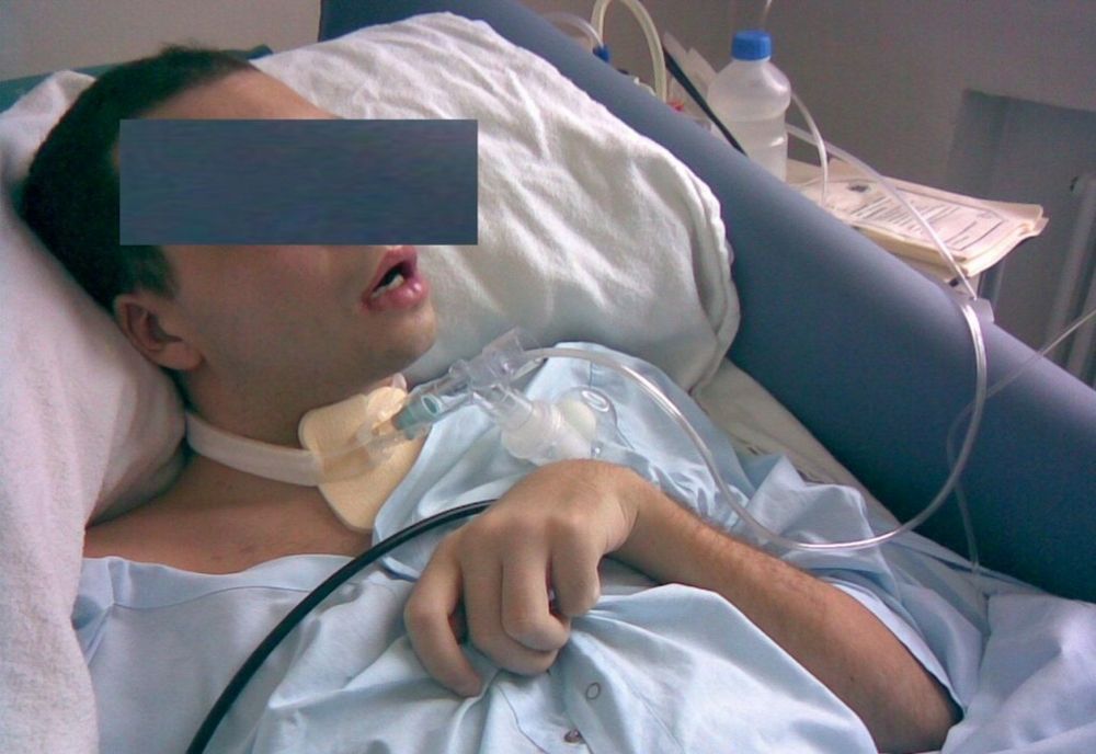 Sentință în dosarul tânărului bătut în fața unui club din Ploiești până a intrat în comă