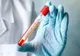 Primul medic din România infectat cu coronavirus