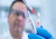  Motivul pentru care în Germania sunt atât de puţine decese de coronavirus. Câte teste se fac pe zi 