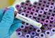 Alte 6 cadre medicale de la Spitalul Județean Ploiești, infectate cu coronavirus. 15 teste incerte! 