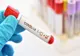 CORONAVIRUS: Au fost înregistrate alte 213 de noi cazuri de îmbolnăvire