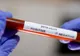 Coronavirus în România- 1.527 de noi cazuri. Care este situația în județe